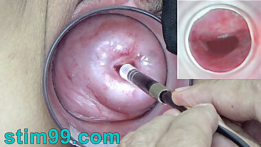 Japanese Endoscope Camera inside Cervix Cam into Vagina