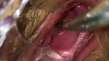 Japanese cervix playing