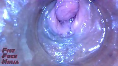 Inside pussy of beautiful Japanese milf (endoscope)