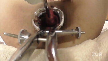 elite MAI.Urethra, clit, vagina and anus masturbate