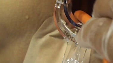 Elmer's Wife Anal fisting speculum 3